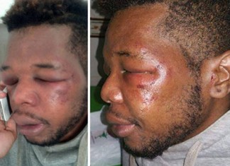 L’AESCT lance une alerte contre le racisme en Tunisie